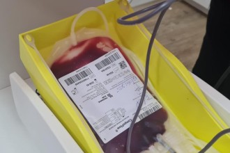 MT Hemocentro atende mais de 500 pacientes com a doença falciforme